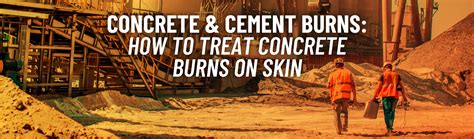 How to Treat Concrete and Cement Burns on the Skin | 360training