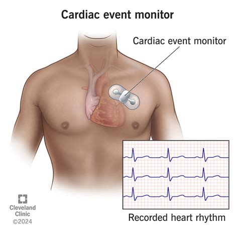 Cardiac (Heart) Event Monitor