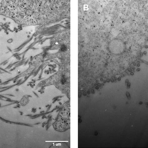 Transmission electron micrographs of negatively stained H9N2 virus ...