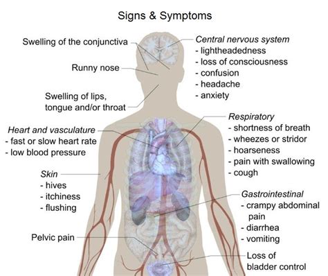 What To Do If Your Child Goes Into Anaphylactic Shock - LFA