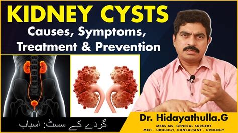 Simple Kidney Cysts | Kidney Cyst Symptoms | Renal Cyst Treatment | Dr ...