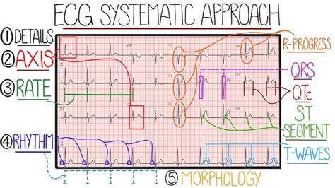 Ecg Interpretation