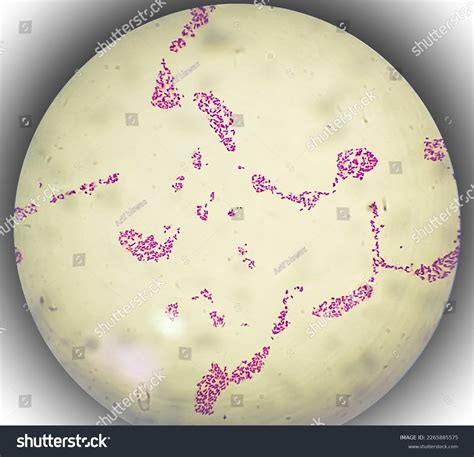 906 Gram Stain Negative Images, Stock Photos & Vectors | Shutterstock