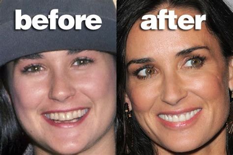 Pin on Celebrity Before and After Photos