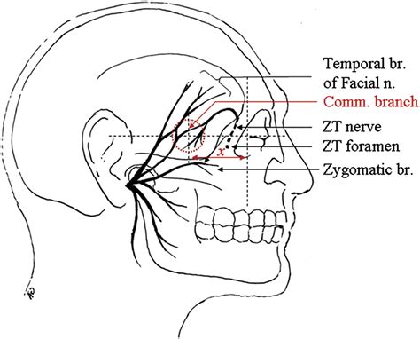 Description of a communication between the facial and ...