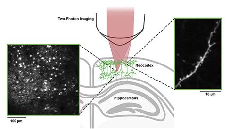 Two-Photon Imaging Monitors Brain Synapses During Prolonged Anesthesia | Features | Nov/Dec 2021 ...