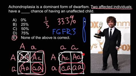 Hypopituitary Dwarfism Vs Achondroplasia