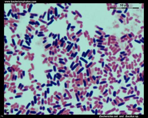 Escherichia coli & Bacillus sp. Magnification: 1000× Gram stain Result:Gram-negative and gram ...