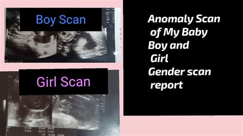 Baby Boy and Baby Girl anomaly scan report for gender| Anomaly scan for baby boy #anomalyscan ...