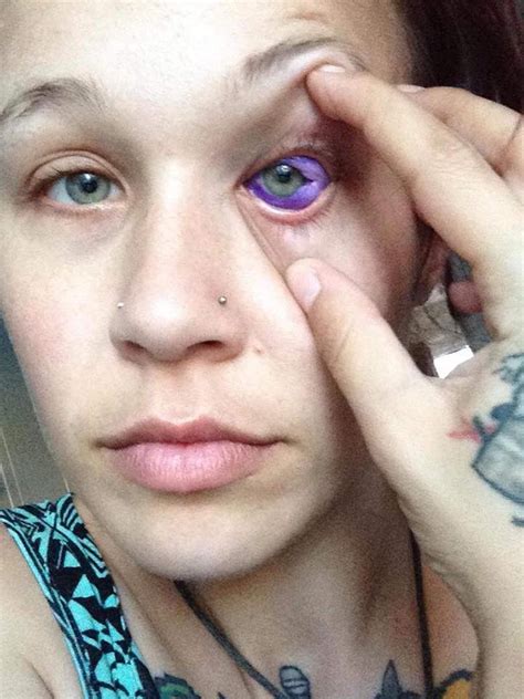 This model got an eyeball tattoo, and of course it went horribly wrong - TheBlaze