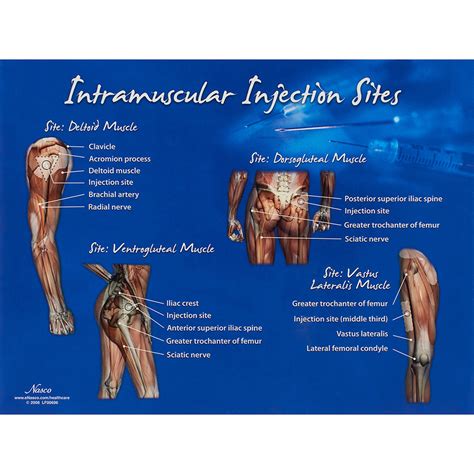 Life/form Intramuscular Injection Sites Chart - AED Superstore ...