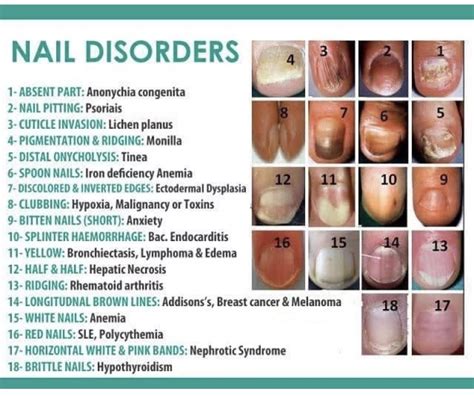 Pin by Lulalu7984 on Dr. /paramedic/nursery | Nail disorders, Nail health, Fingernail health