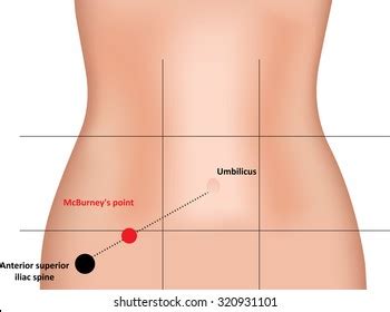 7 Mcburney's Point Images, Stock Photos, and Vectors | Shutterstock