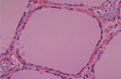 Normal Histology | Normal, Medical education, Pathology