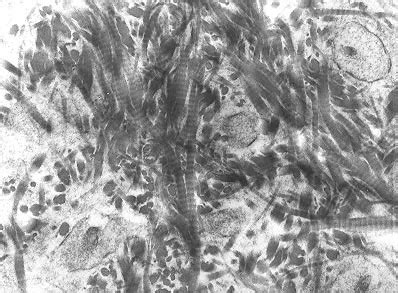 6.3C: Microscopic Anatomy of Bone - Medicine LibreTexts