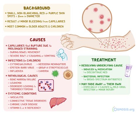 Petechiae Pinpoint Red Dots On Skin Buylomi - vrogue.co