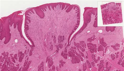 Oral Cavity | histology