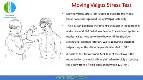 Moving Valgus Stress Test | OrthoFixar 2024