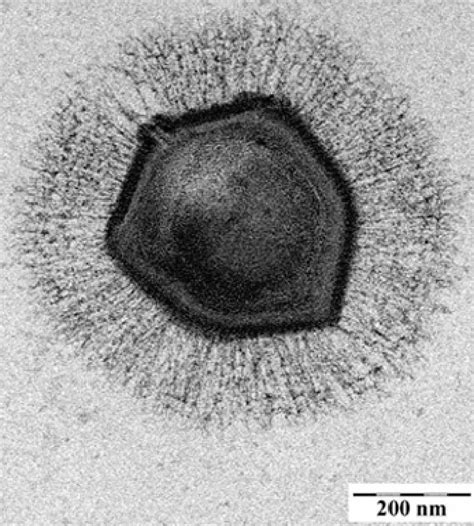 Mimivirus - Alchetron, The Free Social Encyclopedia