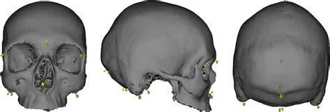 Location of eight landmarks on the cranium in anterior, lateral, and... | Download Scientific ...