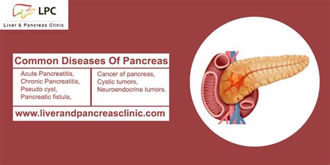 Common Diseases Of Pancreas | Pancreatitis Causes |Pancreas DisordersLPC