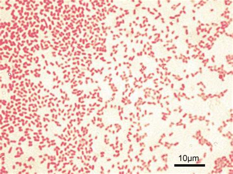 [Figure, Microscopic image of gram-negative Pseudomonas ...