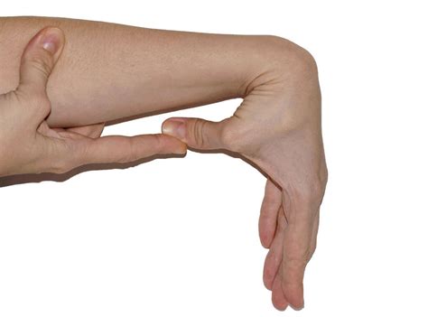 Hypermobility Syndrome: What Is Hypermobility Syndrome?