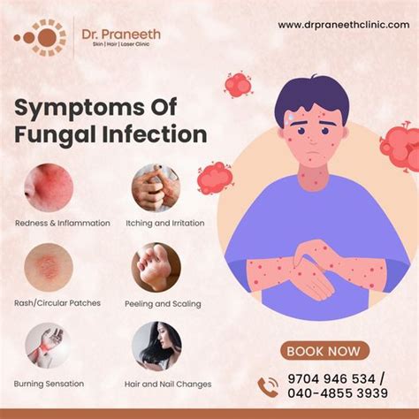 Fungal Infection, Skin Fungus, Causes & Treatment - Dr Praneeth