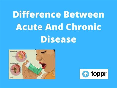 Difference Between Acute and Chronic Disease - Toppr-guides