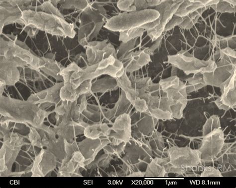 Biofilms, Photo Gallery, The Charles T. Campbell Eye Microbiology Lab, UPMC | University of ...
