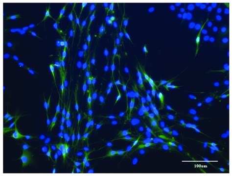 Group D. Immunostained Schwann cell culture after 21 days (scale bar,... | Download Scientific ...