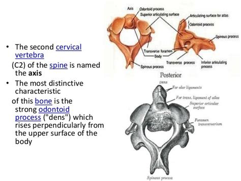 Dens Anatomy - Anatomical Charts & Posters