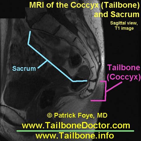 Flickr: Tailbone Doctor