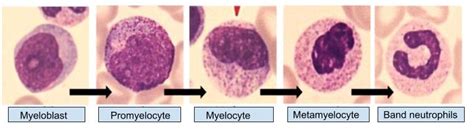 Examples of maturation stages of WBC type, including myeloblast,... | Download Scientific Diagram