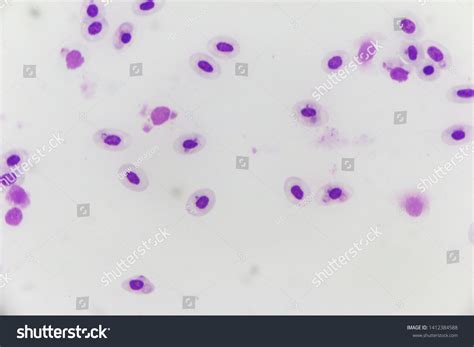 Malaria Parasite Under Microscope View Stock Photo 1412384588 ...