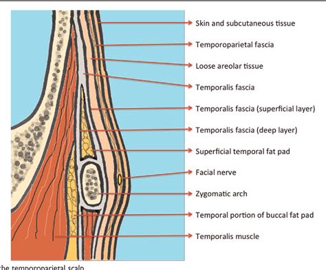 Figure 5 from Safety of Modified Coronal Approach with Dissection Deep ...