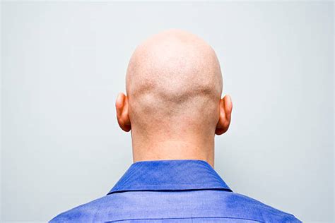 Bald Head Back Stock Photos, Pictures & Royalty-Free Images - iStock