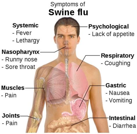 A list of possible causes for flu symptoms with neck and back pain and ...