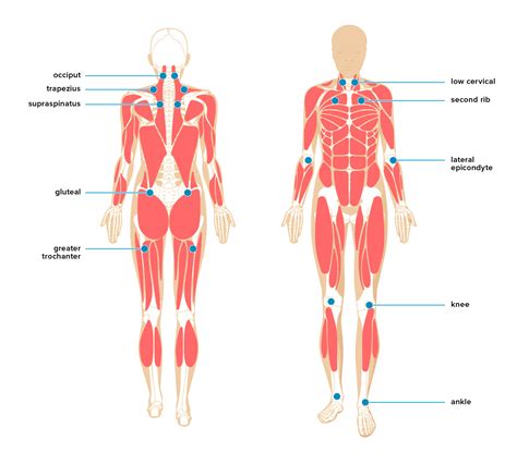 Douleur myofasciale : traitement, symptômes, causes et plus encore