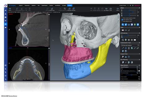 Planmeca introduces new AI-based tools for Planmeca Romexis®