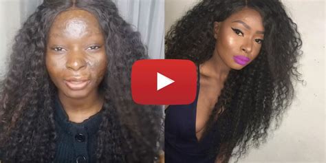 This Inspiring Burn Survivor Has the Most Powerful Makeup Tutorials You ...