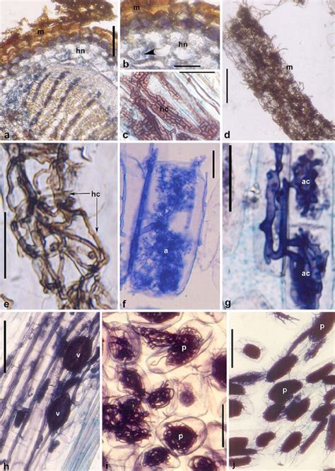 a-i Photomicrographs of mycorrhizal types in roots of shola plant ...