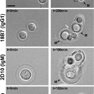 Concentration-dependent capsular (quellung) reaction. Light microscopy ...