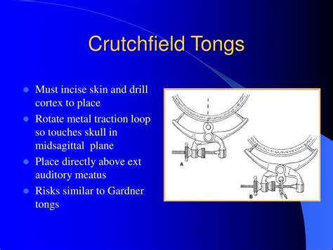 PPT - Orthopaedic Traction PowerPoint Presentation, free download - ID ...