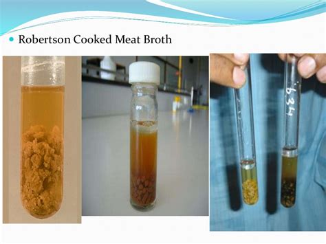 Anaerobic Culture Methods