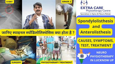 Spinal Spondylolisthesis & Anterolisthesis | Full Grading system , Test ...