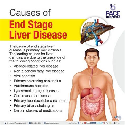 Signs Of Dying Liver | ecclesarcheryclub.uk