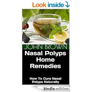 Nasal Polyps Home Remedies: How To Cure Nasal Polyps Naturally, John Brown, Tracy McMillan ...