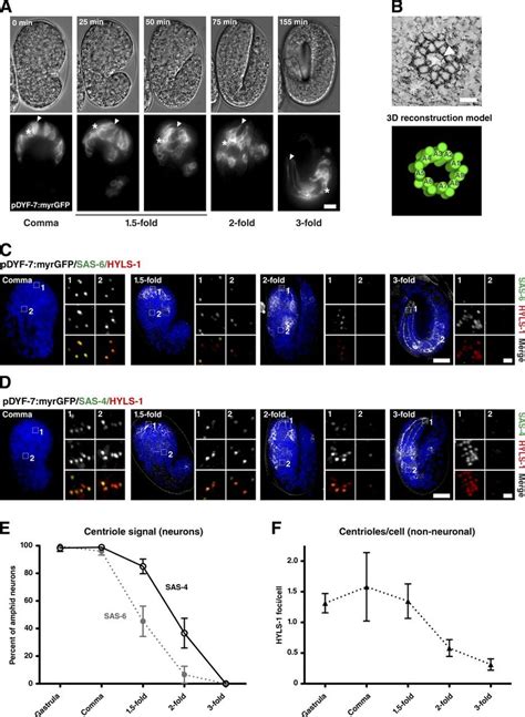 Centrioles are lost early in neuronal differentiation. (A) Stills from... | Download Scientific ...