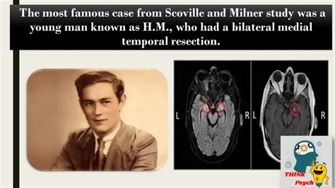 Case study of HM & RB| Scoville & Milner study: Bilateral Medial Temporal Resection| #ignou ...